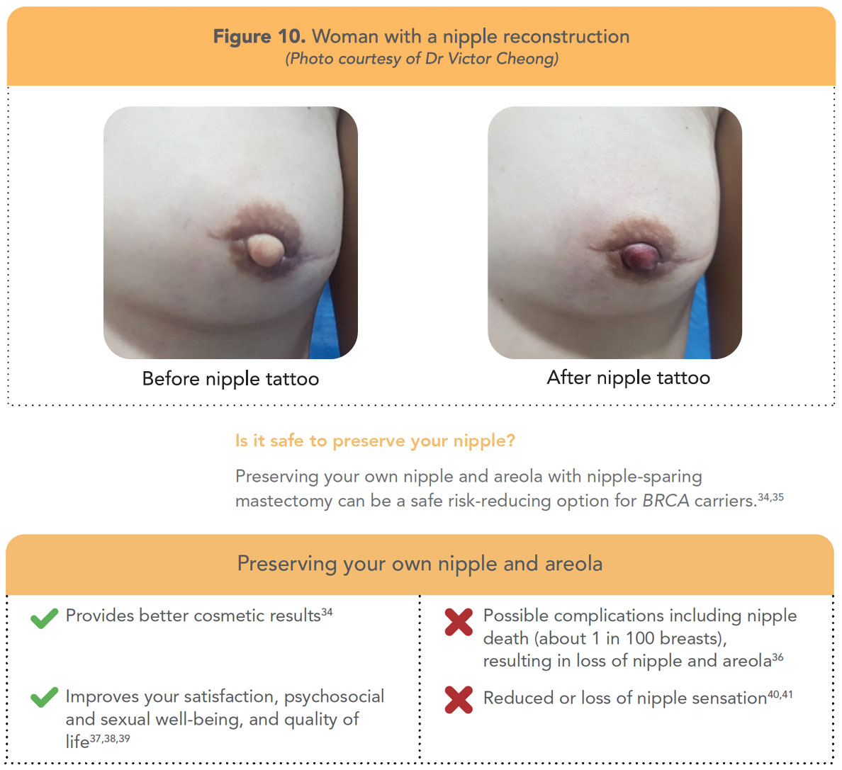 Will Sensation Return After Nipple Reconstruction?